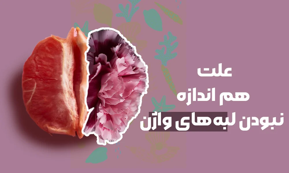 بیرون زدگی لابیا، عامل ناراحتی حین پوشیدن لباس تنگ و عفونت های مکرر